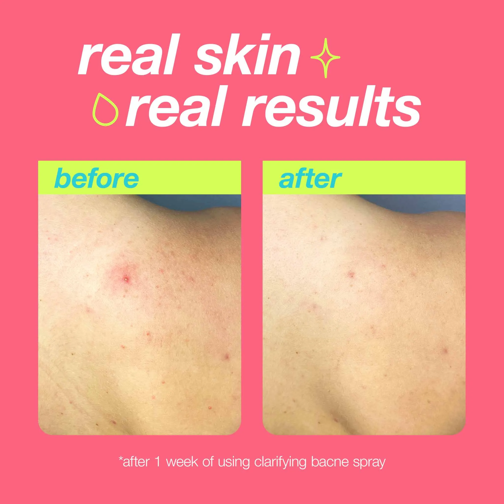 Dermalogica Clear Start Clarifying Bacne Spray